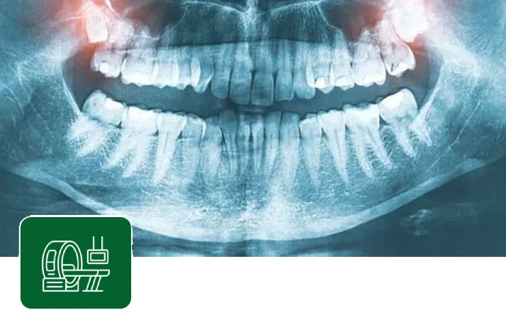 cbct scan in coimbatore